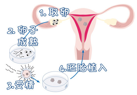 关于明远生殖医学中心